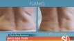 Coolsculpting at Vein Med Solutions