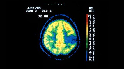 Apakah Benar Kita Hanya Menggunakan 10% Otak Kita?