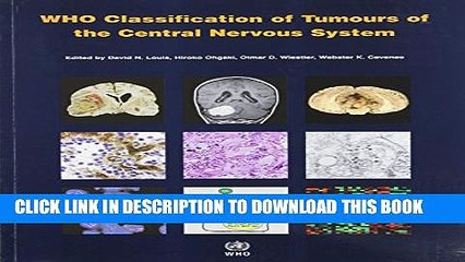 [PDF] WHO Classification of Tumours of the Central Nervous System Full Online
