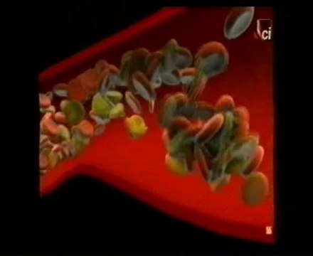 Anticonceptivos orales y tabaquismo: Autopsia forense