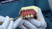 Preventing Periodontal Disease - Westfield Smiles - Dentist in Westfield, NJ