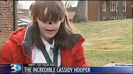 Cette fille est née sans nez et sans yeux