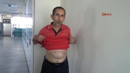 Adana Hastalıklarla Mücadele Ederken Emekli Olabilmek İçin Dava Açtı