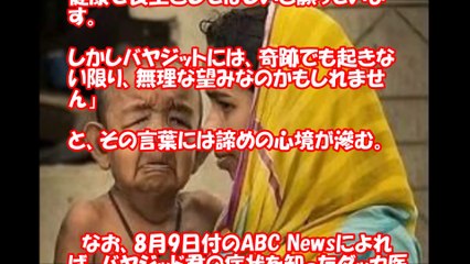 4歳なのに80歳の風貌！  差別と貧困に喘ぐ  リアル「ベンジャミン・バトン」