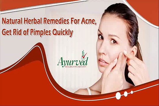 Natural Herbal Remedies For Acne, Get Rid of Pimples Quickly