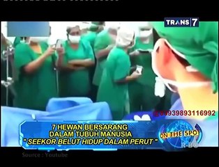 On The Spot   7 Hewan Bersarang Dalam Tubuh Manusia