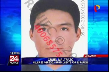 Arequipa: Mujer es agredida brutalmente por su expareja