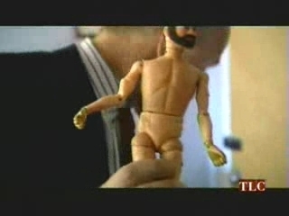 The Man Whose Arms Exploded