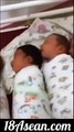 Astonishing Footage of Twin Babies  Don't Know They've Been Born Yet! Must See!