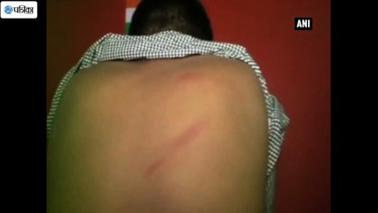 Teen Thrashed By Teacher For Snapping Plant Stem