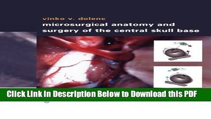 [PDF] Microsurgical Anatomy and Surgery of the Central Skull Base Ebook Free