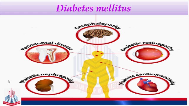 Sex Influenced Trait & Diabetes Mellitus