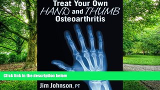 Big Deals  Treat Your Own Hand and Thumb Osteoarthritis  Free Full Read Most Wanted