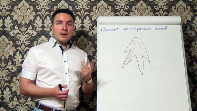 Евгений Грин — Почему отекают ноги — причины отёков