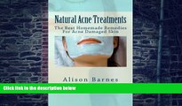 Big Deals  Natural Acne Treatments: The Best Homemade Remedies For Acne Damaged Skin  Best Seller