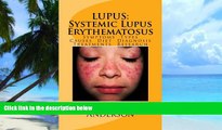 Must Have PDF  LUPUS:  Systemic Lupus Erythematosus: Symptoms. Types. Causes. Diet.  Diagnosis.