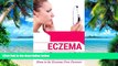 Big Deals  Skin Care: Eczema Treatment for beginners (2nd EDITION REVISED AND EXPANDED) - How to