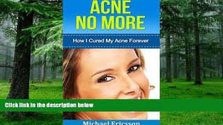 Big Deals  Acne: How I Cured My Acne Forever: Ex-Sufferer Discovers Powerful Secret To Acne Free
