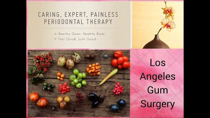 Gum Grafting Treatment