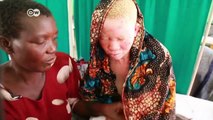 Albinos under threat in Africa | DW News