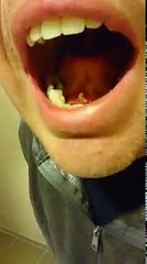 Il retire de la salive solidifiée de sous sa langue ! BEURK