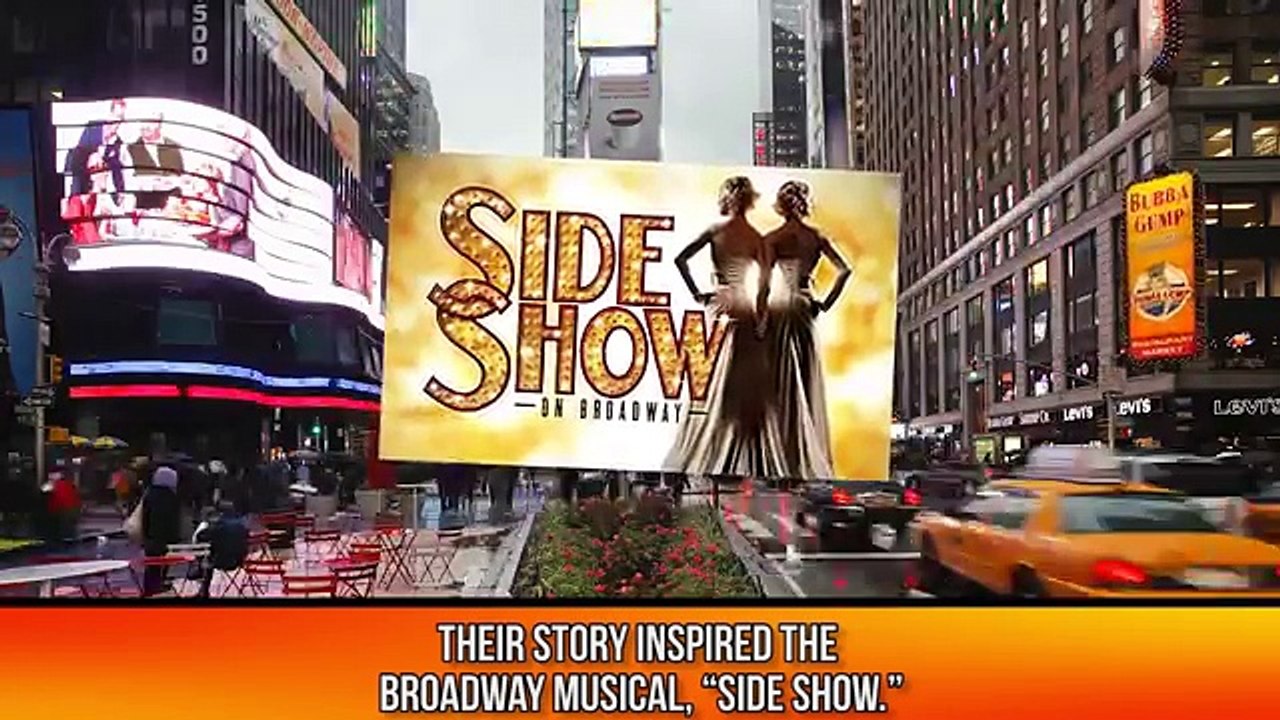 The Most Amazing Conjoined Twins