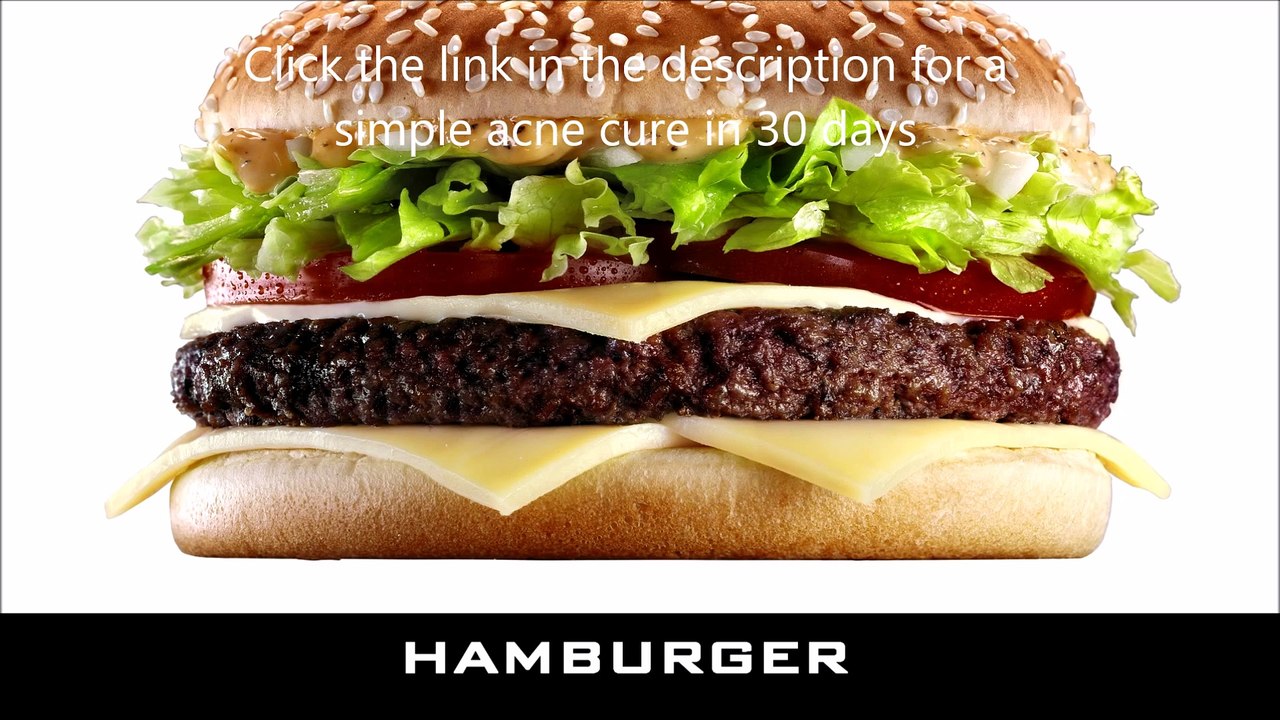 acne causing foods