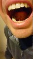 Depuis plusieurs jours, il avait mal sous la langue...regardez ce qui est sorti de l'une de ses glandes salivaires