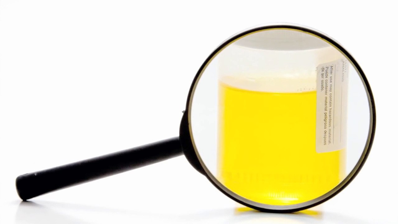 Avoiding Chicken To Avoid Bladder Infections