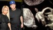 Blac Chyna & Rob Kardashian REVEAL Sex Of Baby