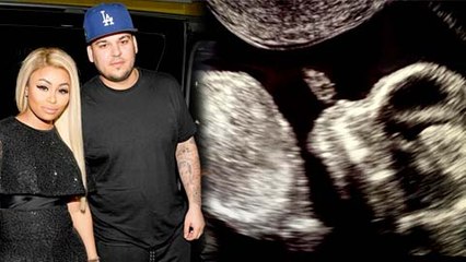 Blac Chyna & Rob Kardashian REVEAL Sex Of Baby