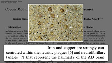 Alzheimer’s Disease, Copper, and Saturated Fat