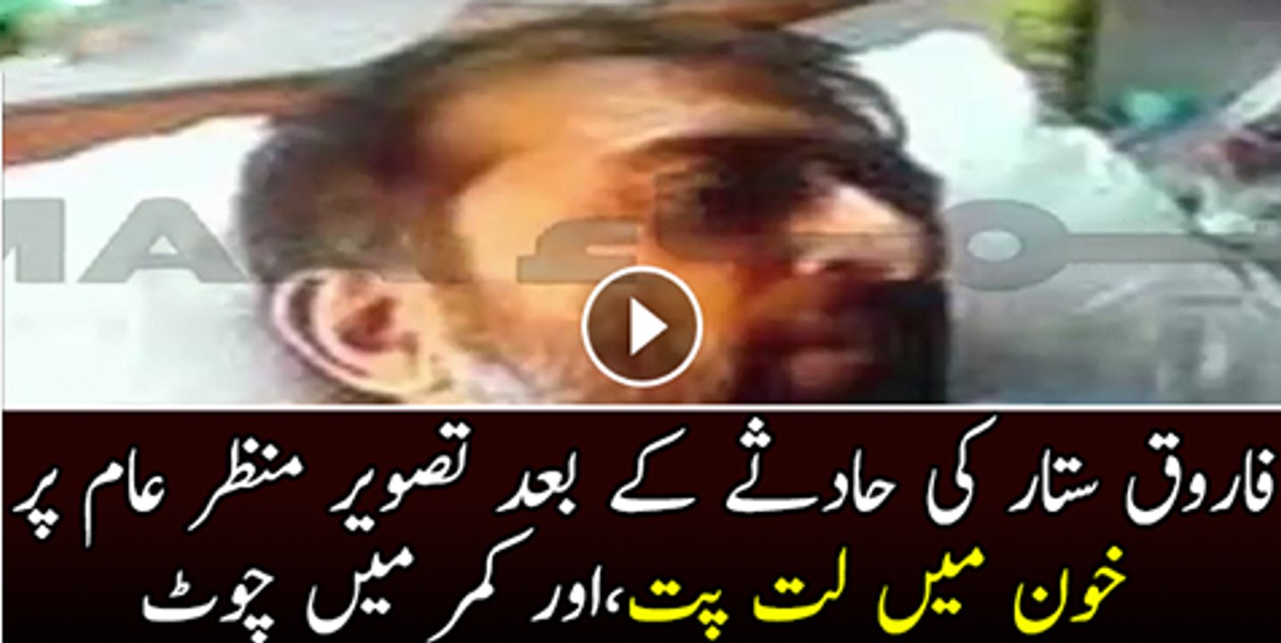 Farooq Sattar Ki Hadse K Bad Tasveer Manzare aam Par AA Gai