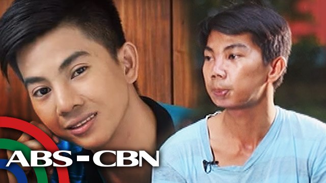 Mission Possible: Botched Nose Job