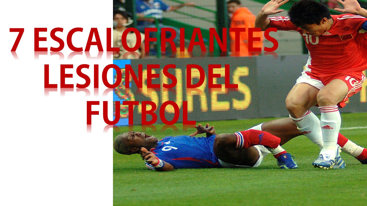 7 ESCALOFRIANTES LESIONES DEL FUTBOL