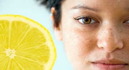 Facial Blemishes | How To Remove Blemishes Naturally On Face (TOP 5 HOME REMEDIES)