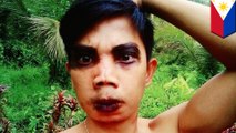 Filipino model forced to work as Halloween ghoul after botched $10 nose job