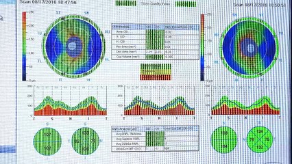 Welcome to Maple Ridge Eye Care