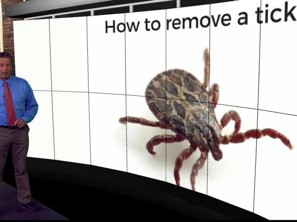 Tick Removal