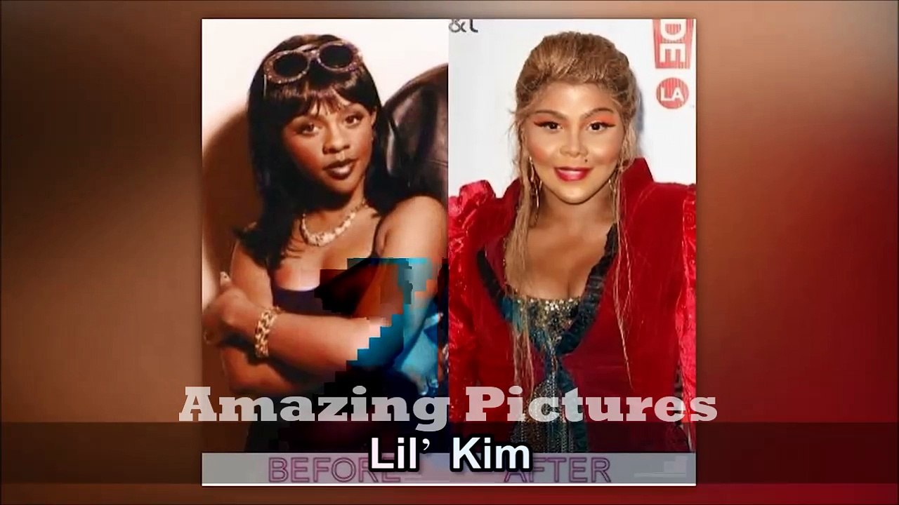 23 Worst Celeb Plastic Surgeries Ever