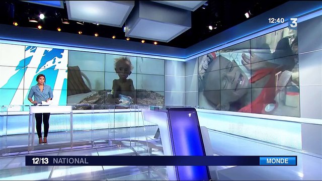 Yémen : plus d'un million d'enfants menacés par la malnutrition