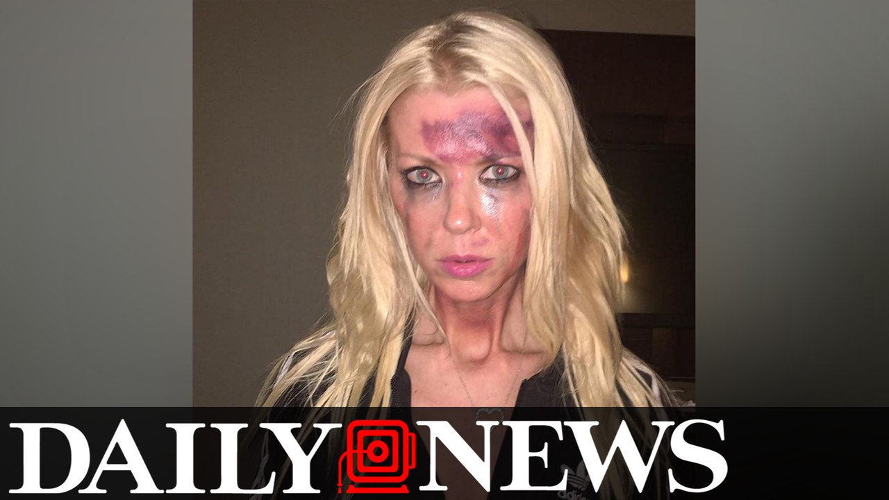 Tara Reid Shares Scary Photo Of Bruised Face On Social Media