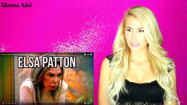 Celebrity Plastic Surgery Gone Wrong Famous People Who Unrecognizable Before and After Images Dianna