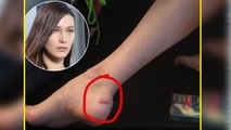Bella Hadid Injured Her Ankle After Serious Fall At Fashion Week