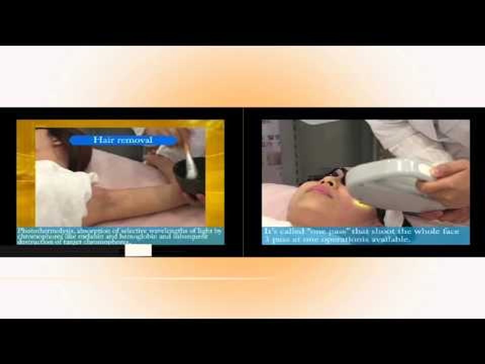 Salud, Belleza y Nutrición - Luz pulsada - Vellísimo