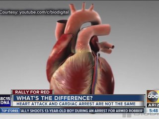 What's the difference between cardiac arrest and a heart attack?