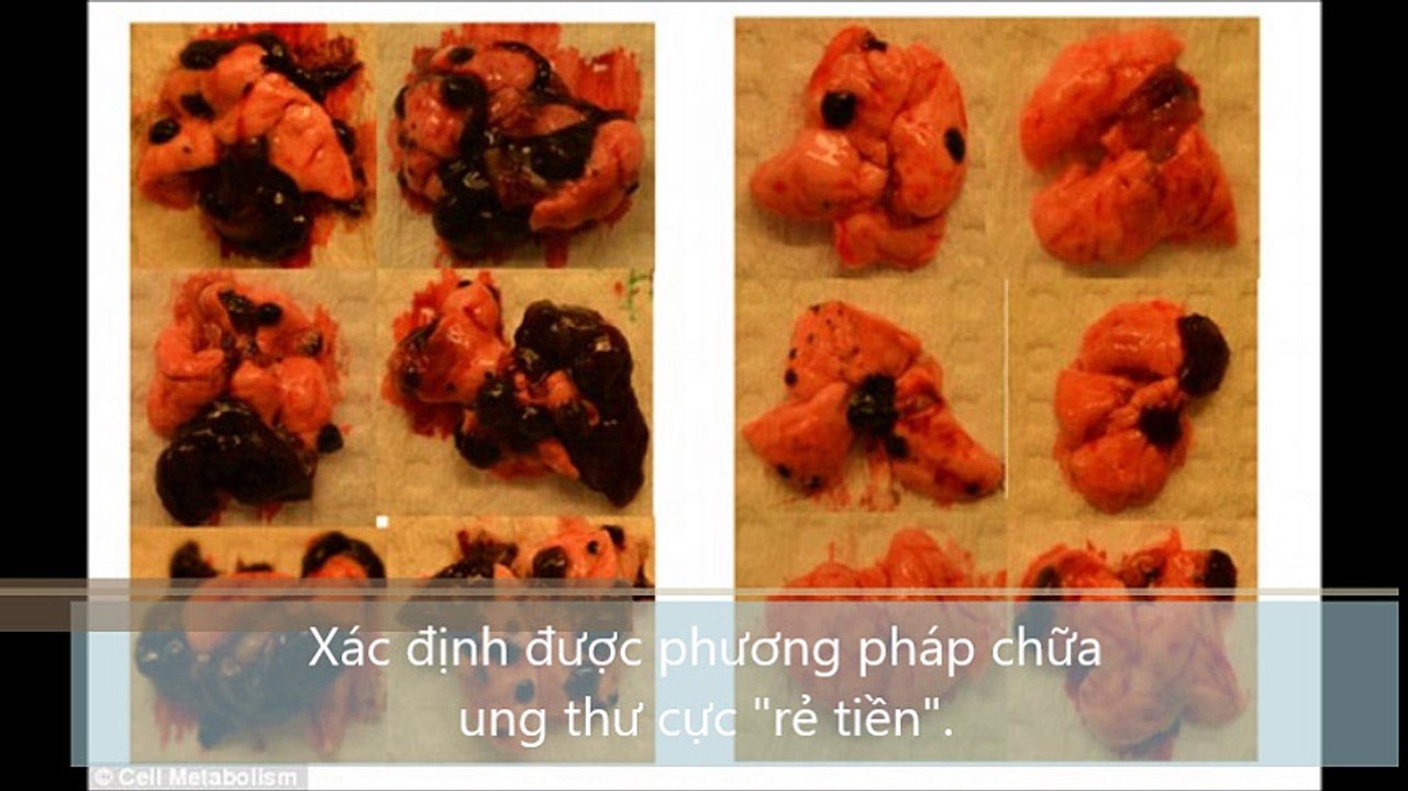 Xác định được phương pháp chữa ung thư cực rẻ tiền