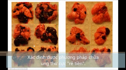 Xác định được phương pháp chữa ung thư cực rẻ tiền