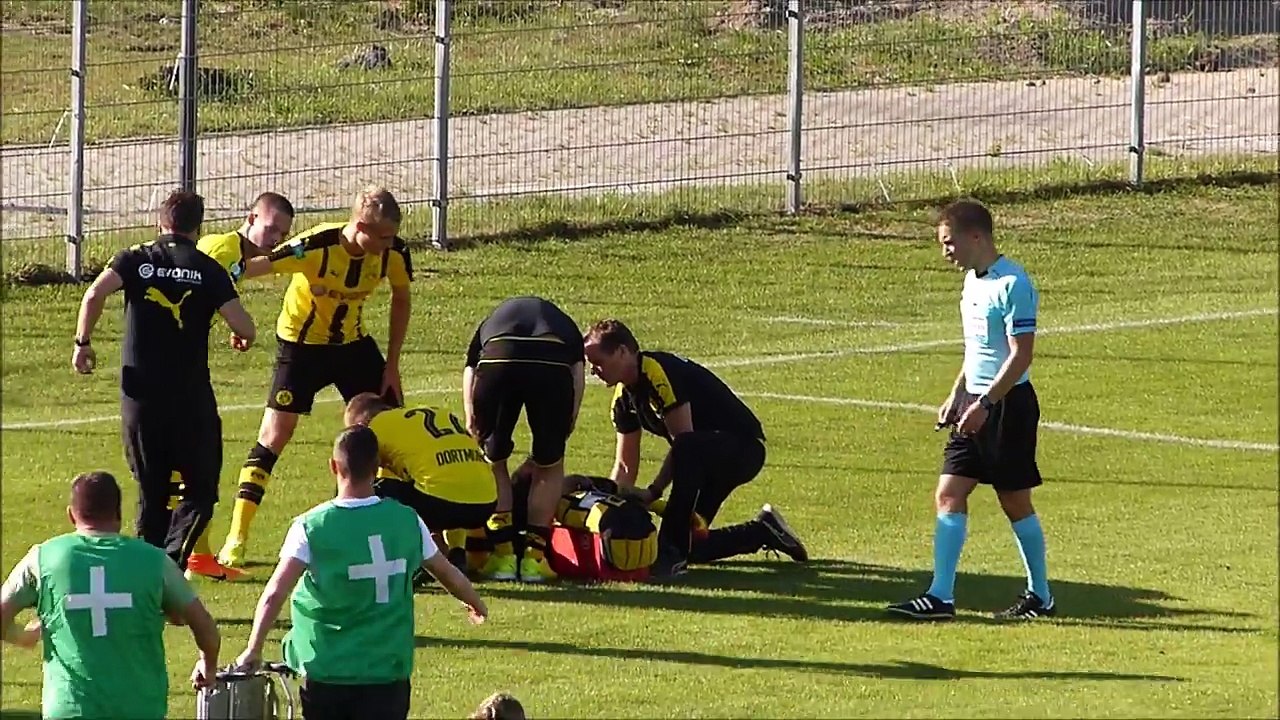 La terrible fracture de la jambe de Dario Scude...