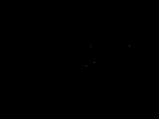 Wool: Australia's Secret Shame